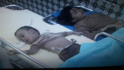 "محلي الجوف" يدين جرائم العدوان السعودي بحق اليمنيين