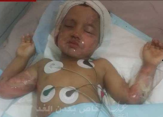 مقتل أسرة في عدن جراء اشتباكات بين مرتزقة العدوان