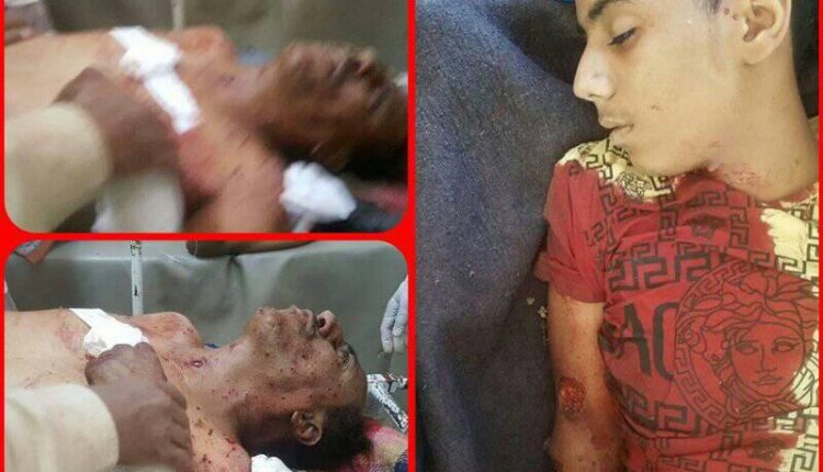 استشهاد 22 مدنيا بينهم أطفال في اشتباكات بين المرتزقة بداخل المدينة القديمة بتعز