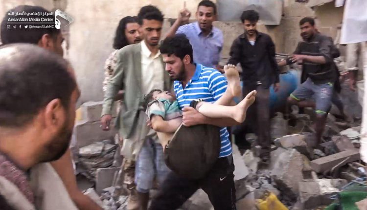 وزارة الصحة: 77 شهيدا وجريحا حصيلة ضحايا غارات العدوان على العاصمة صنعاء