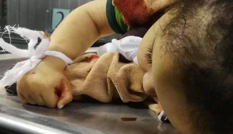 5 شهداء و40 إصابة بقصف إسرائيلي على قطاع غزة