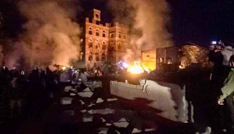 وزارة-الصحة-إصابة-سبع-نساء-وطفلين-جراء-غارات-العدوان-الأمريكي-على-العاصمة-صنعاء-1-1130×580 (1)